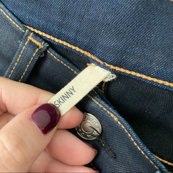 ⭐️ Rag & Bone | Dark Wash Skinny Jeans - Picture 12 of 12
